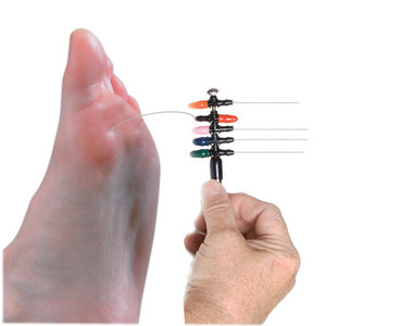 Monofilament Testing on the Hands and Feet