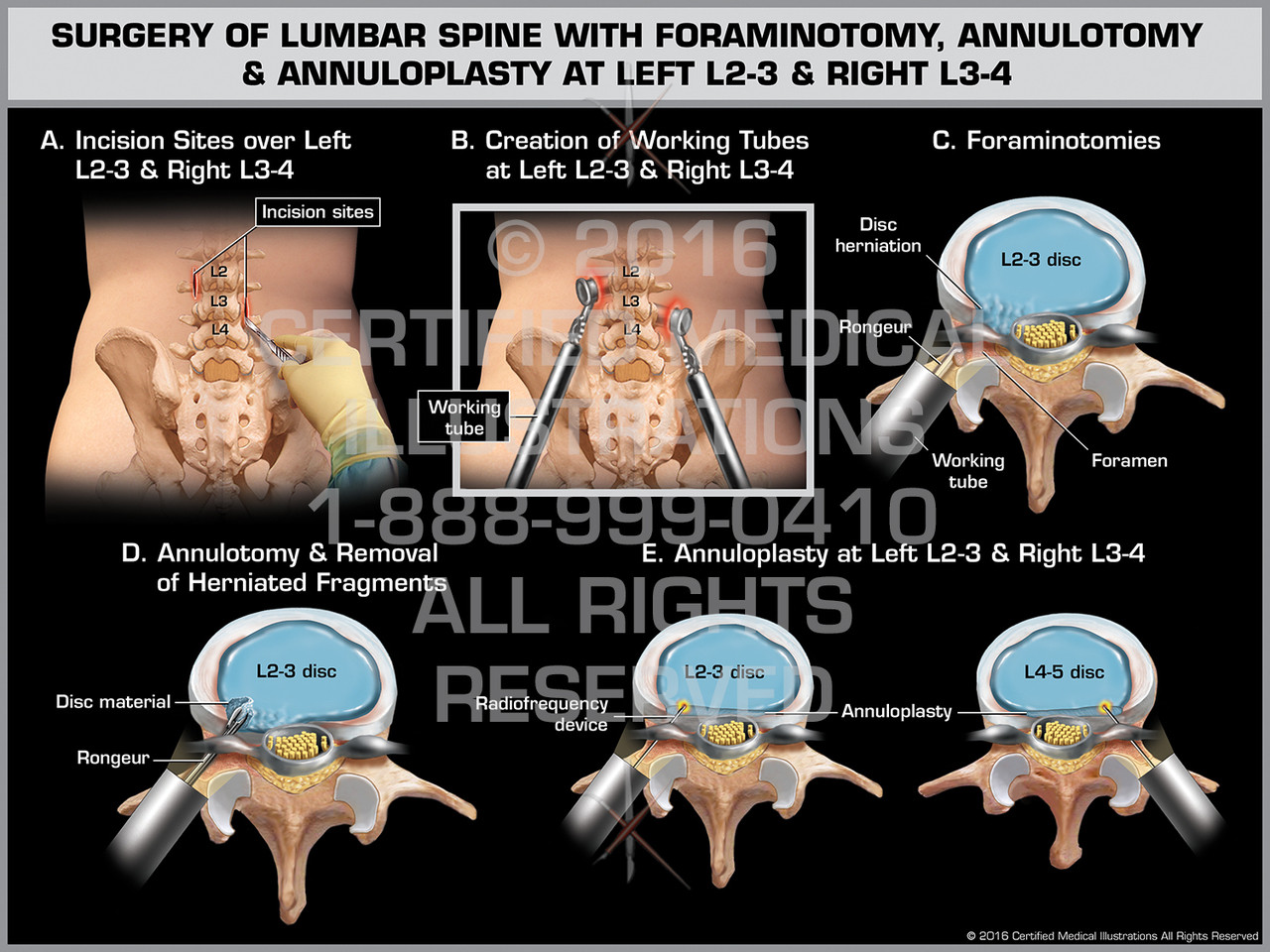 l2 l3 spine