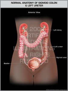 Normal Anatomy of Sigmoid Colon & Left Ureter Male