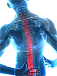 Back pain relief with a sacroiliac belt