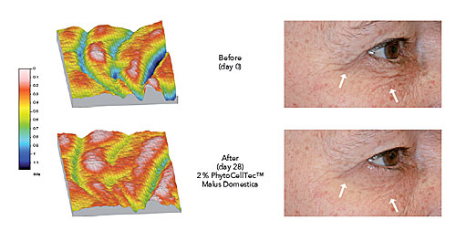before-after-eye.jpg apple stem cells effect on crows feet