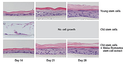 stem-cells-young-old.jpg Skin stem cells young versus old
