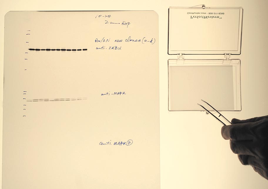 perfectmembrane-gelimage-web.jpg PerfectFilm with Membrane