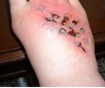 do you have an infected tattoo body4real co uk do you have an infected tattoo body4real co uk