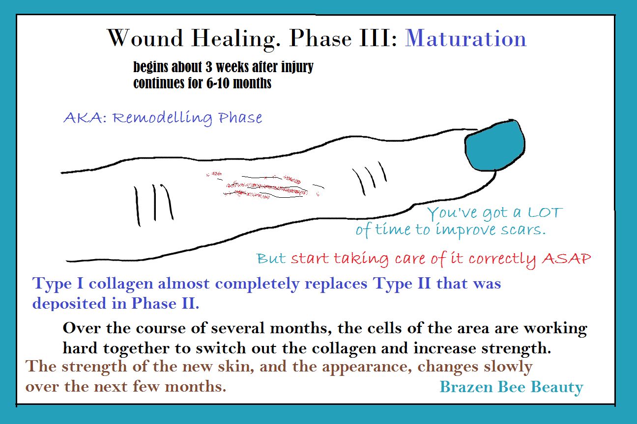 Healing Scars Brazen Bee