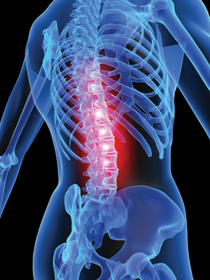 Weak back muscles cause pain and bad posture.