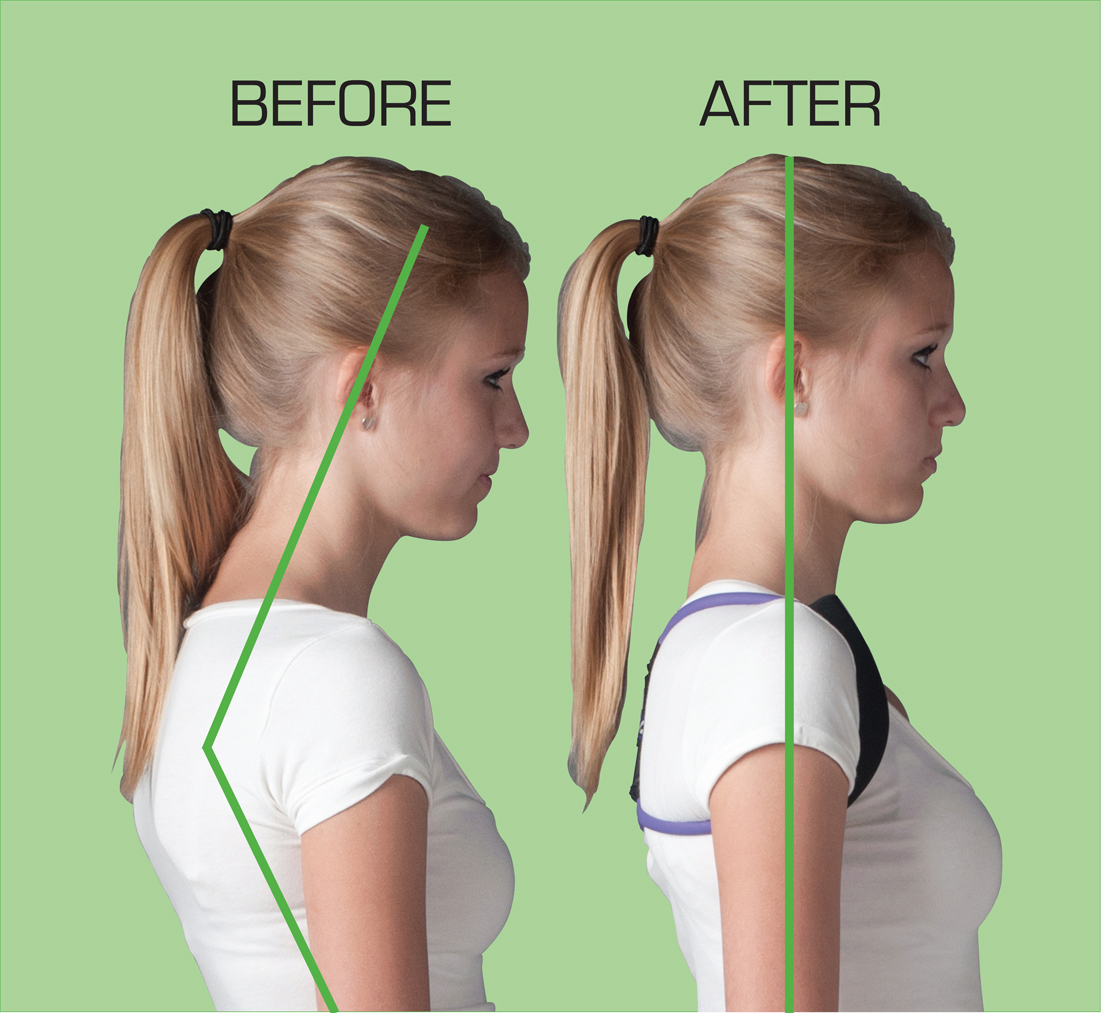 Where Do You Stand A Guide To Proper Posture Vitality Depot   Before After Layout 1 