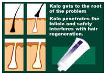 Kalo gets to work at the root of each hair