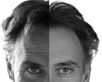 menswrinklesforehead