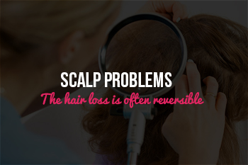 Itchy Scalp and Hair Loss