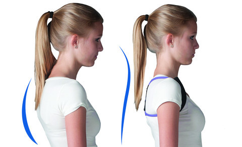 posture-medic-before-after-1.jpg